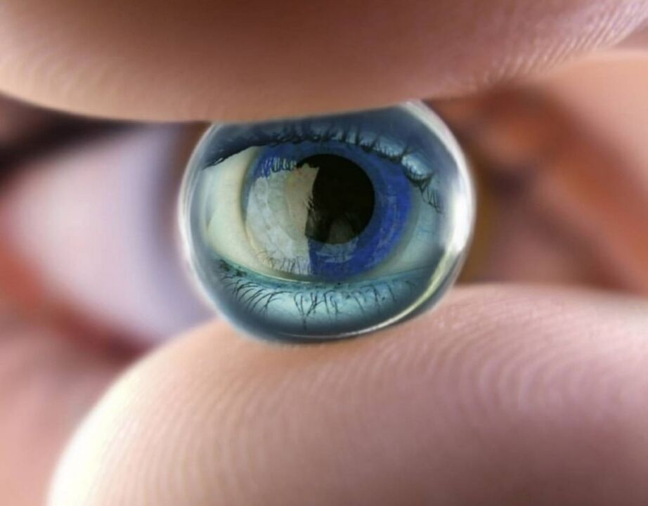Orthokeratology night lenses stop the progression of vision loss